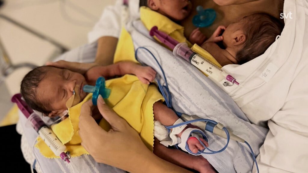 Stiligt - En person håller tre nyfödda barn med slangar och nappar, alla inlindade i gula filtar och tätt liggande på bröstet.